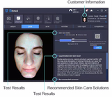 Analyseur portatif intelligent 160G de soins de la peau de l'image 1024*1280 d'AI